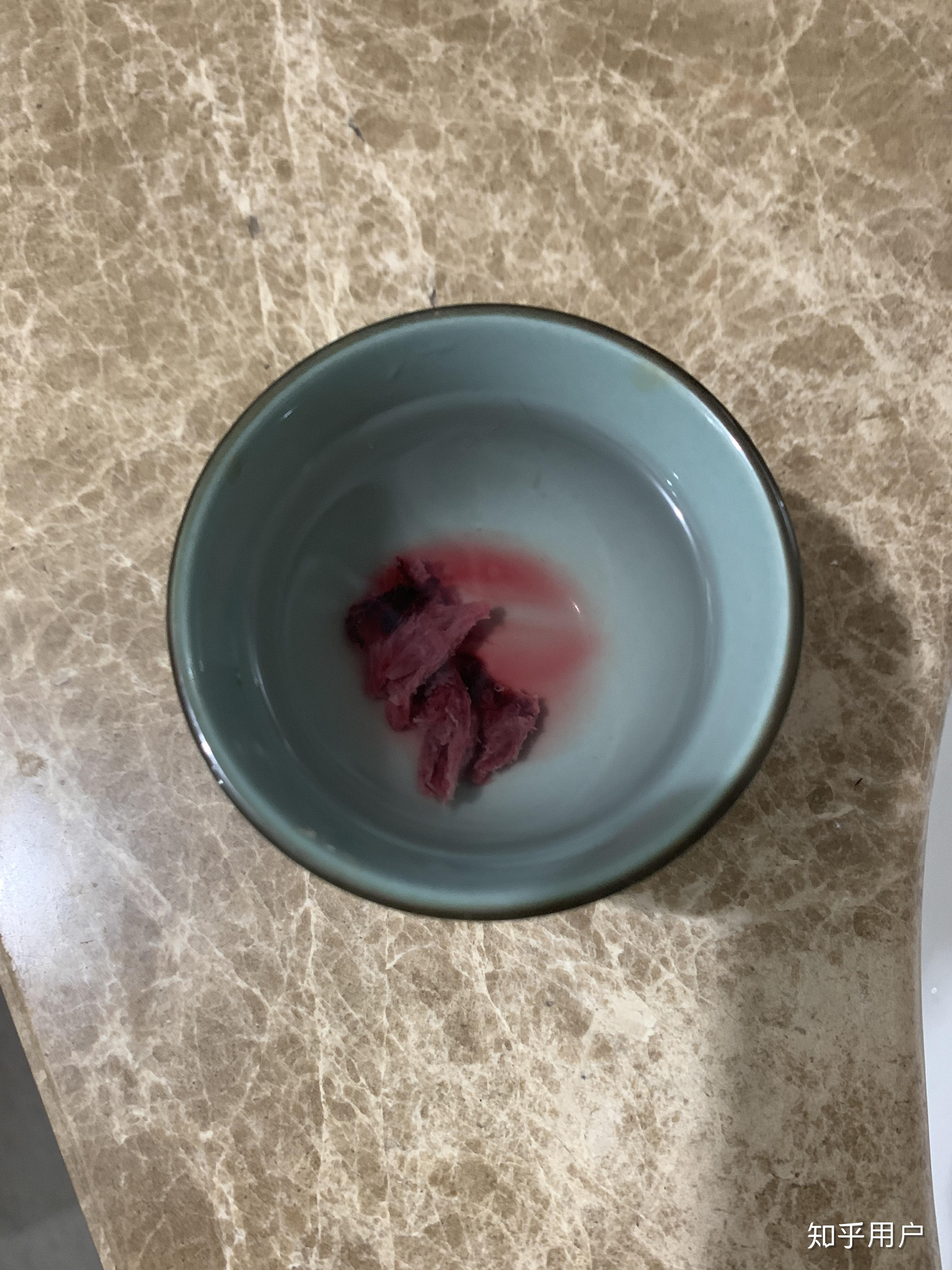 因为我有时候有血块?