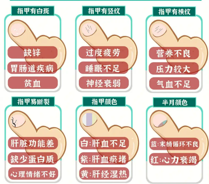 中医教你：看指甲、辨健康 - 知乎