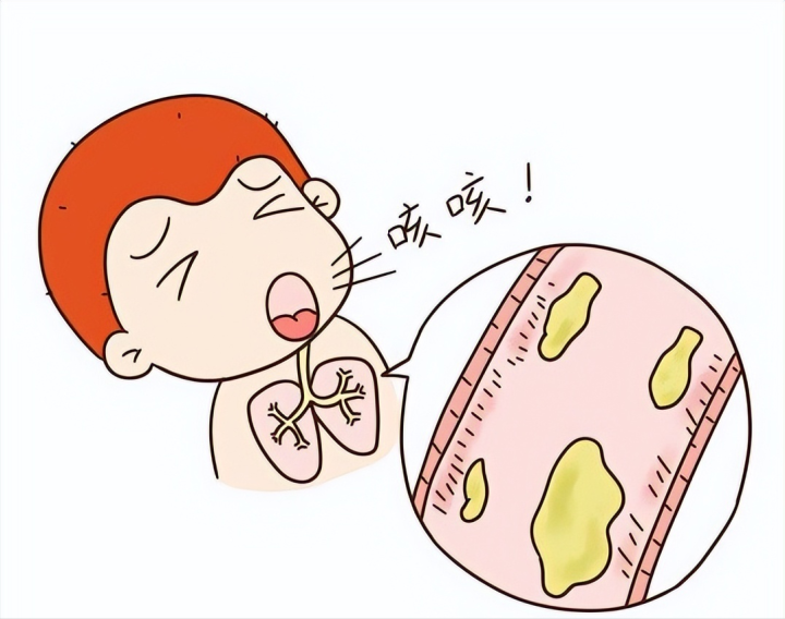 痰在哪,病在哪!中医教你用中成药,化解全身上下,五脏六腑之痰 - 知乎