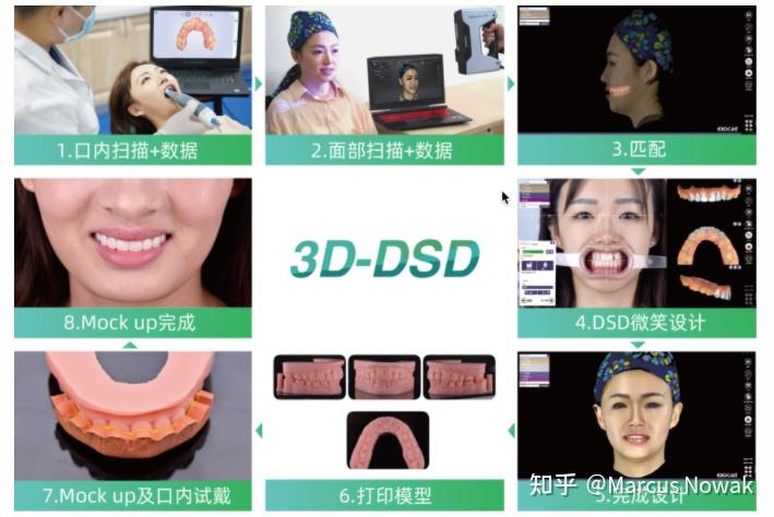 电子面弓与面扫:种植牙中咬合精准度及面部美观的把控官 - 知乎