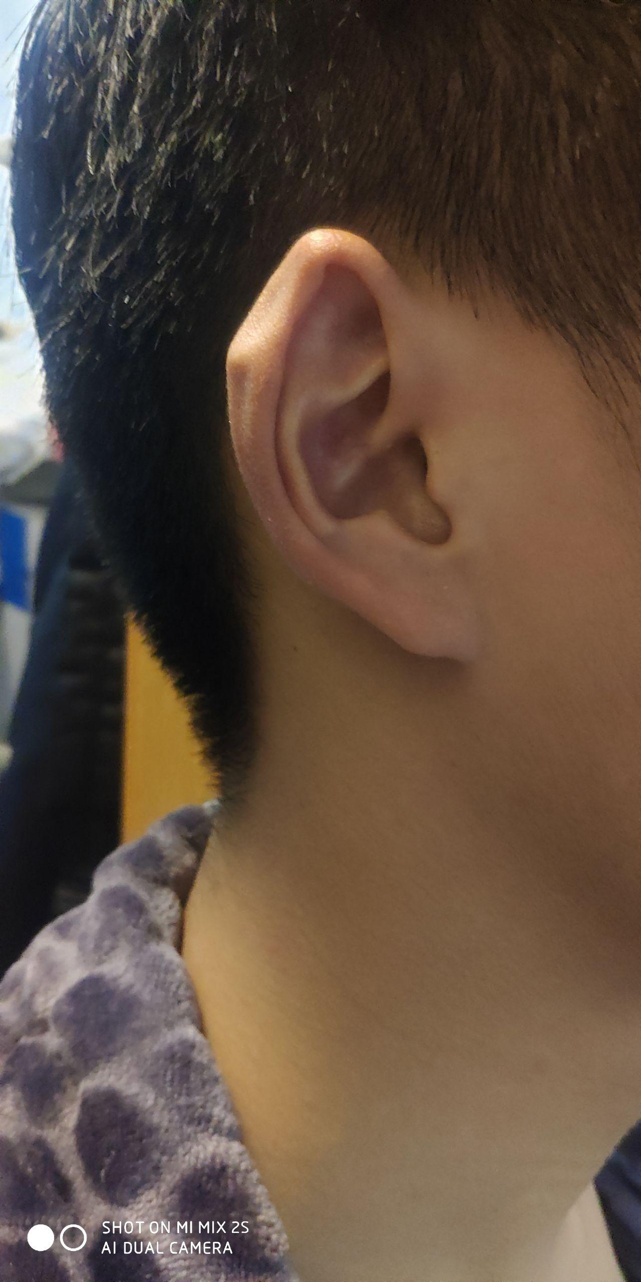 大多数人的耳朵上端是圆的为什么有极少人的耳朵上端是尖的像兔子耳一