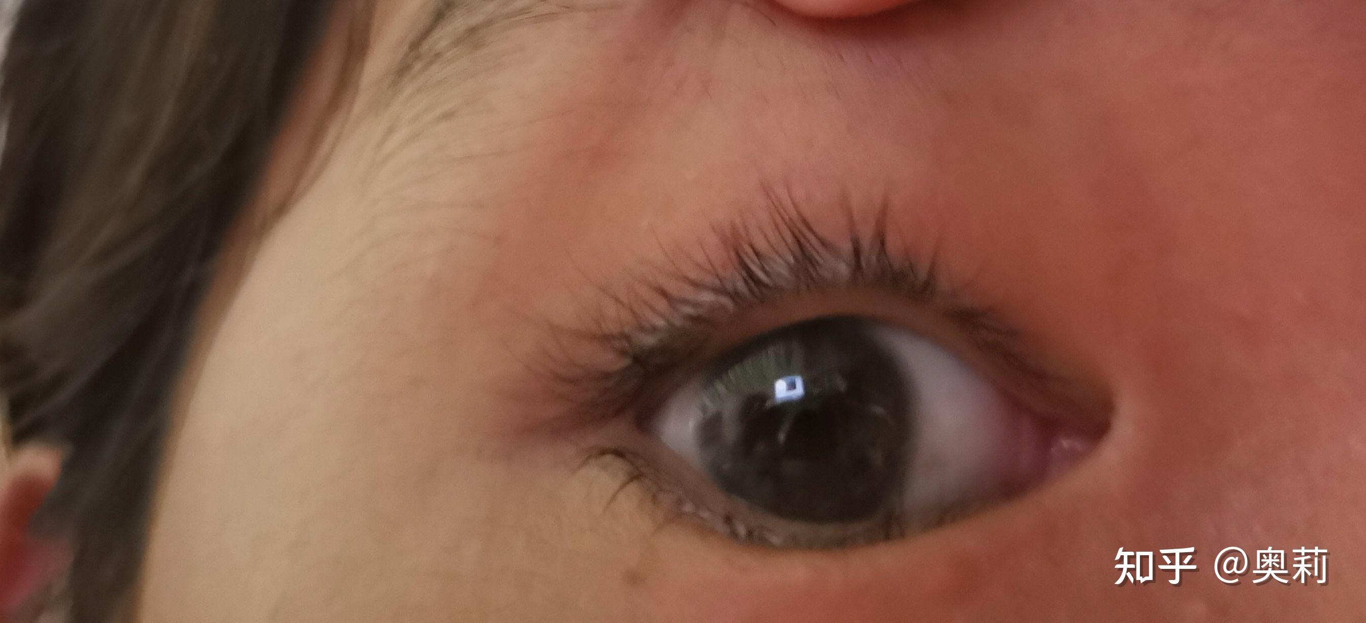 双睫症到底是啥