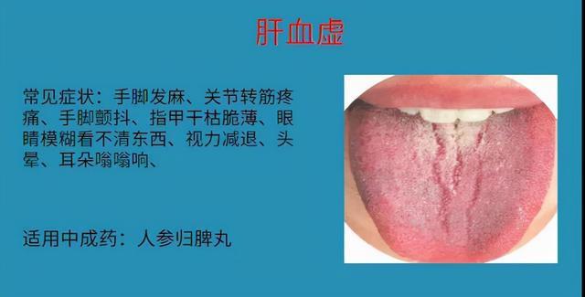 想要改善身体,先来看看自己属于气虚还是血虚吧!血虚症状自测表 - 知乎