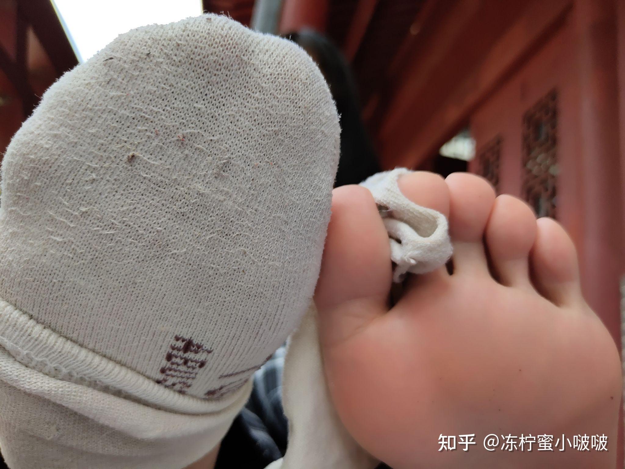 女孩的脚真的都很酸吗