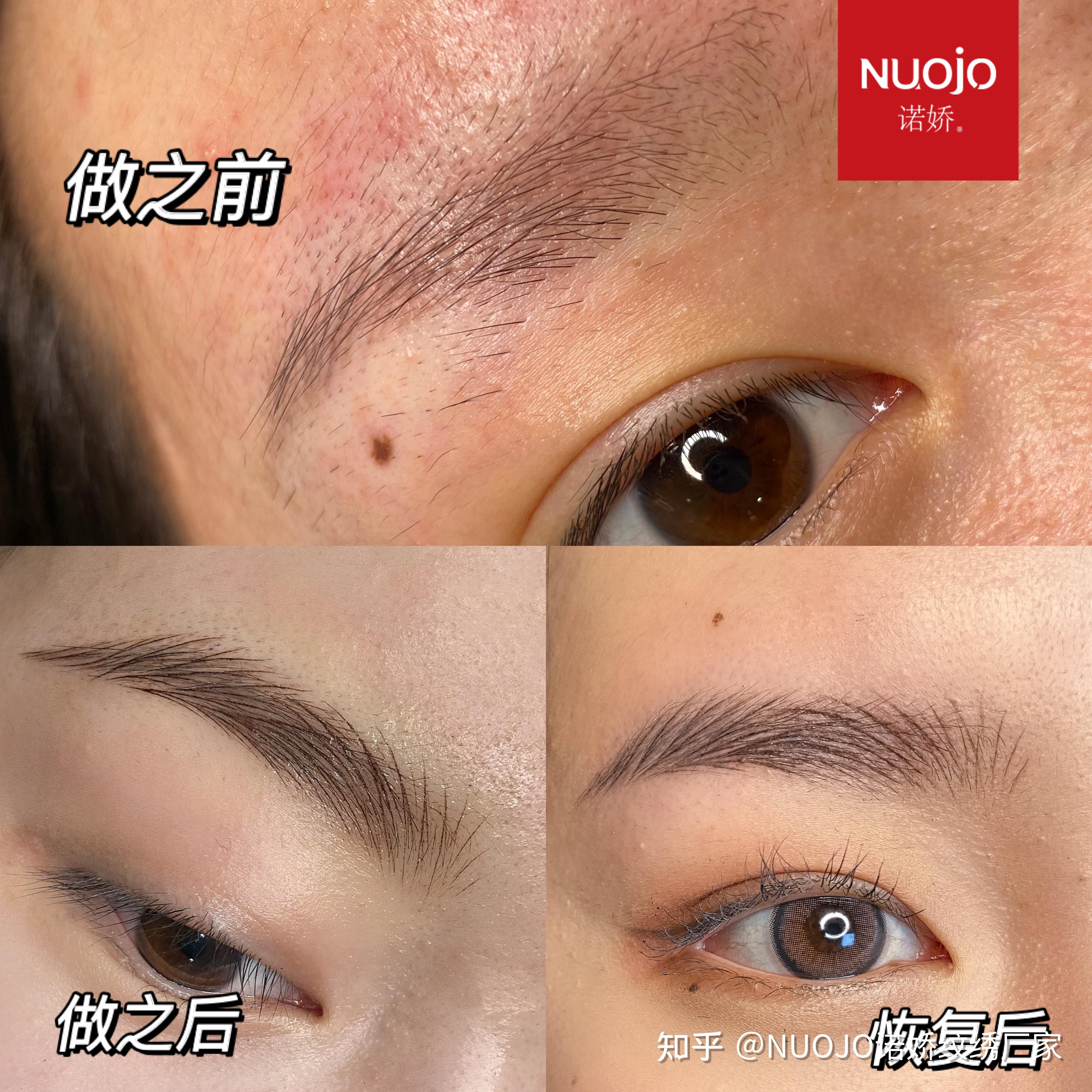 请教大家半永久眉毛两年后掉色能掉完吗?