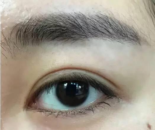 为什么有人的内眼角是圆的