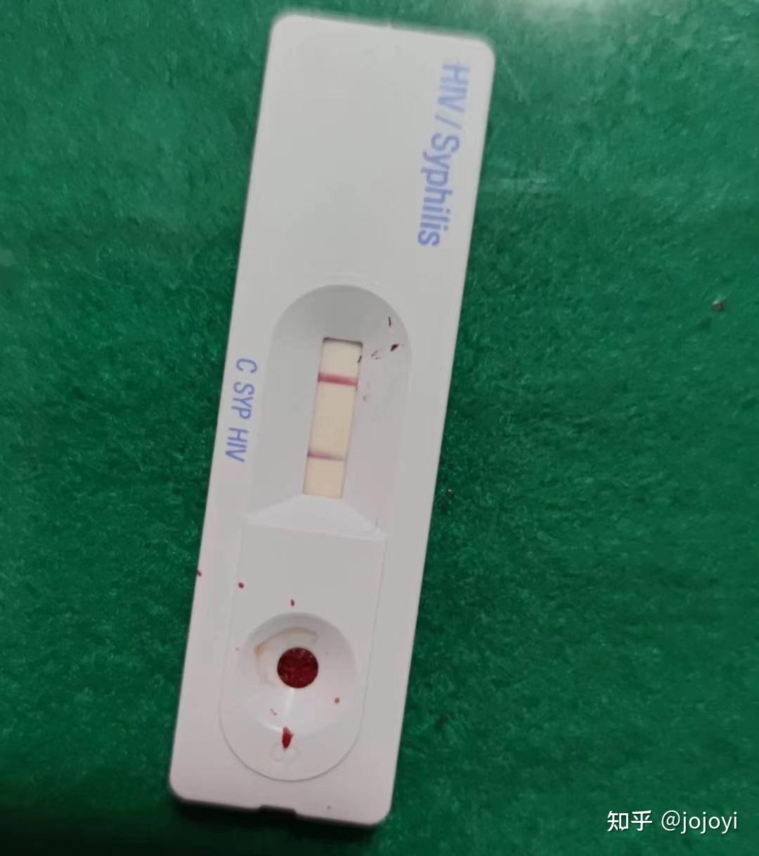 买了两个牌子的hiv试纸,都是两道杠,是不是基本坐实了?