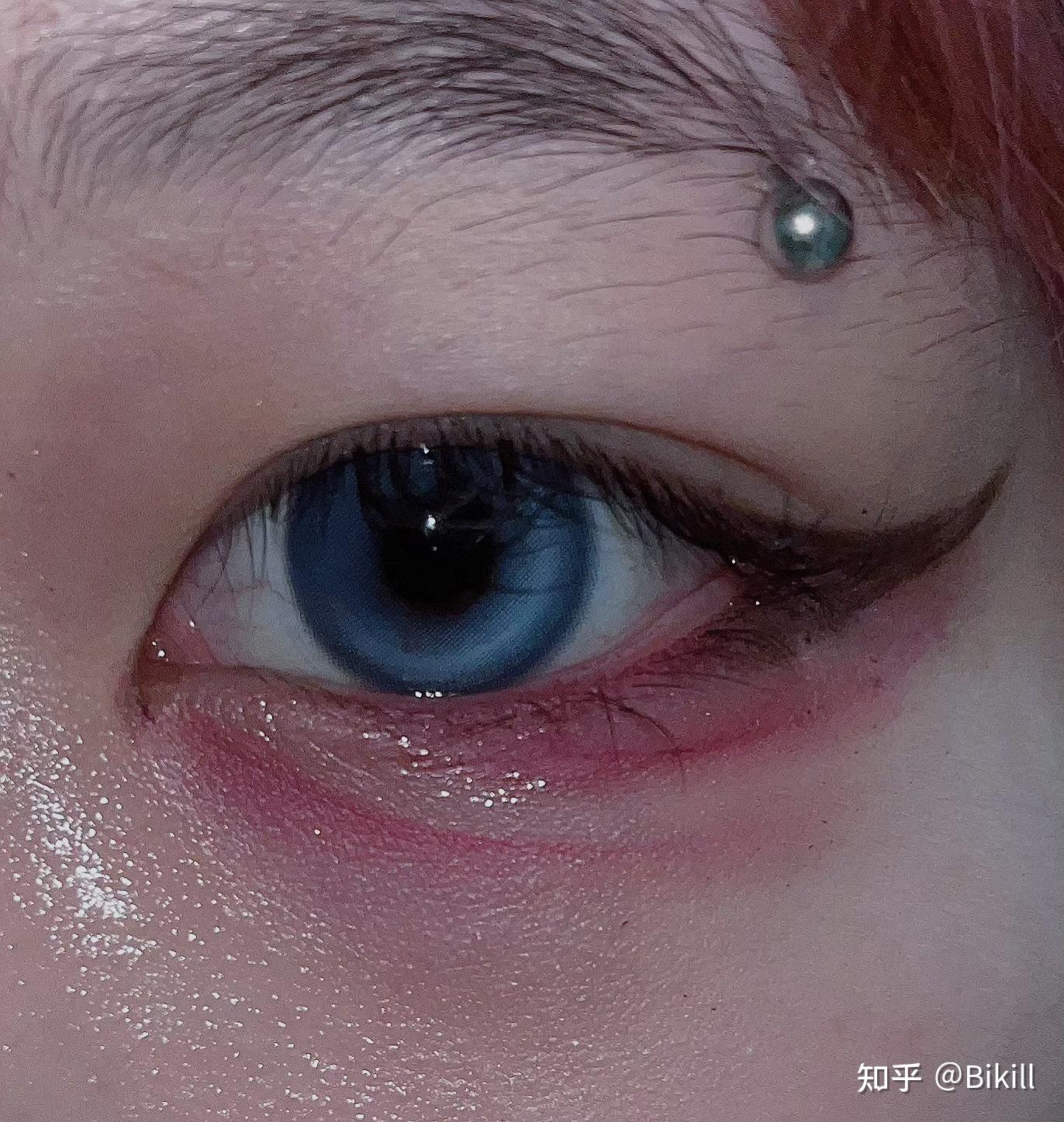 我想看看唇钉摘下后是什么样子的? - 知乎