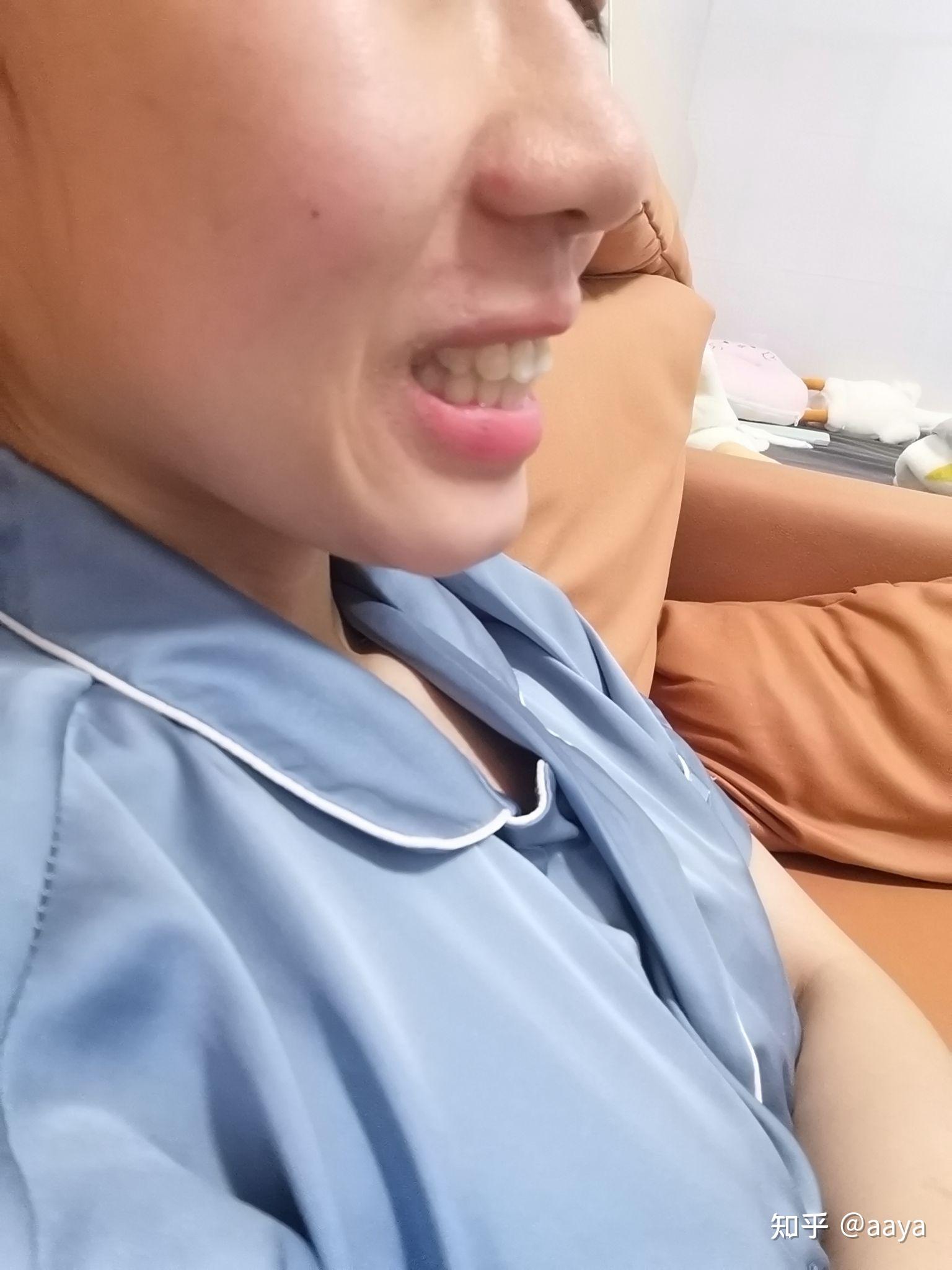 上牙齿包住下牙齿这是正常的么麻烦知友帮我看看