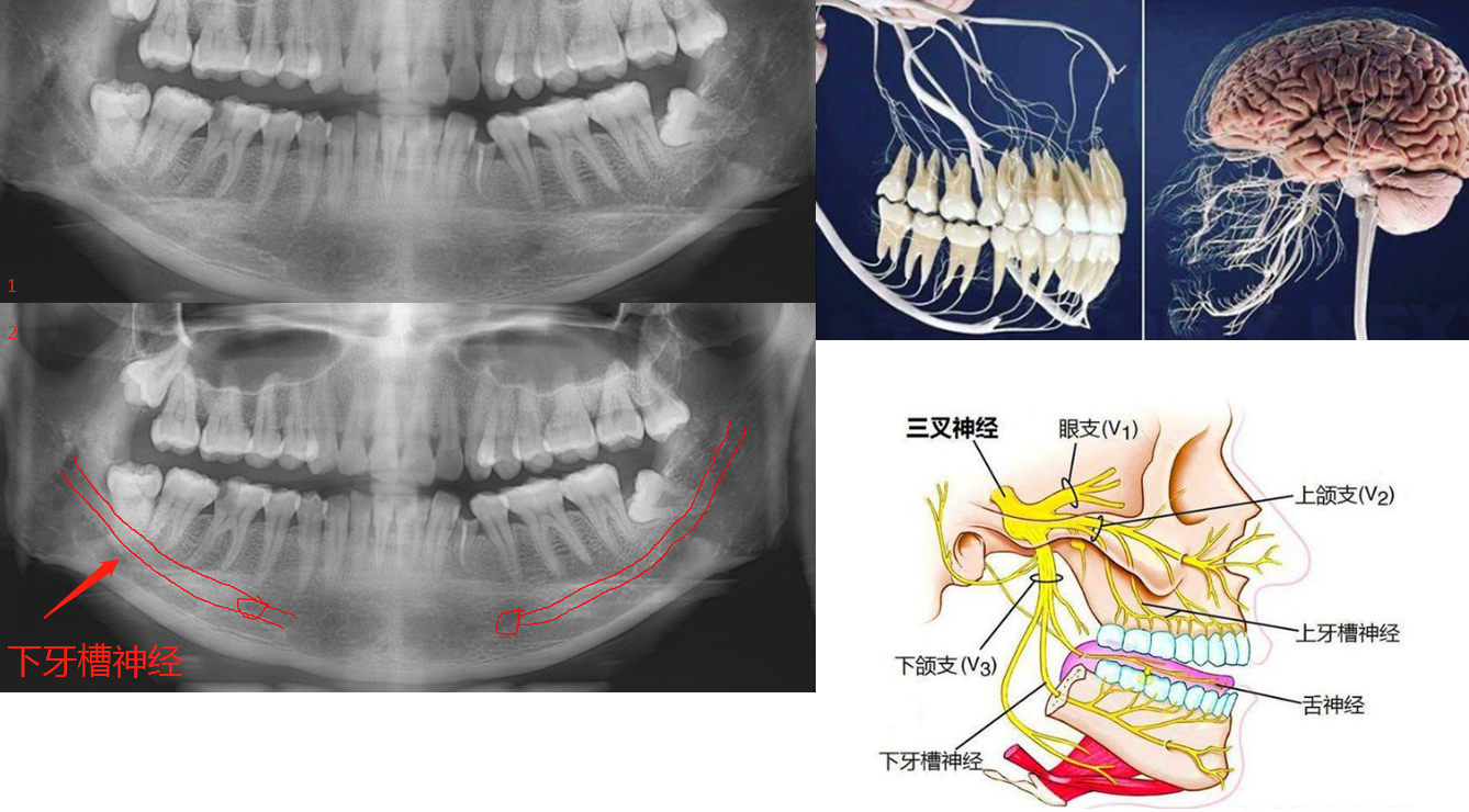 牙齿的神经连接到何处