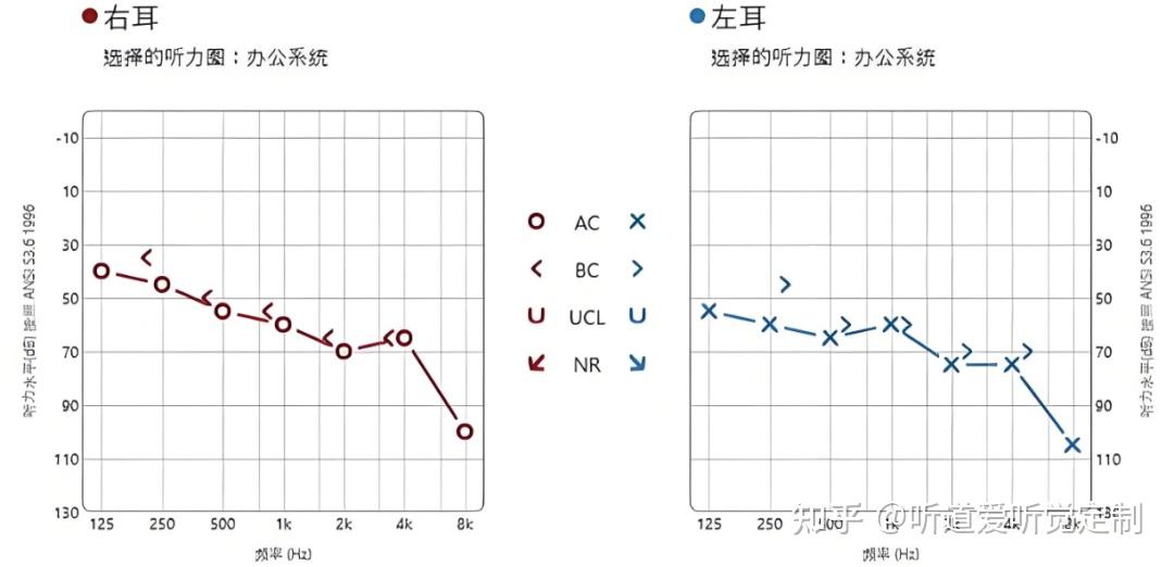 哪种类型的听损，助听效果最好？ - 知乎