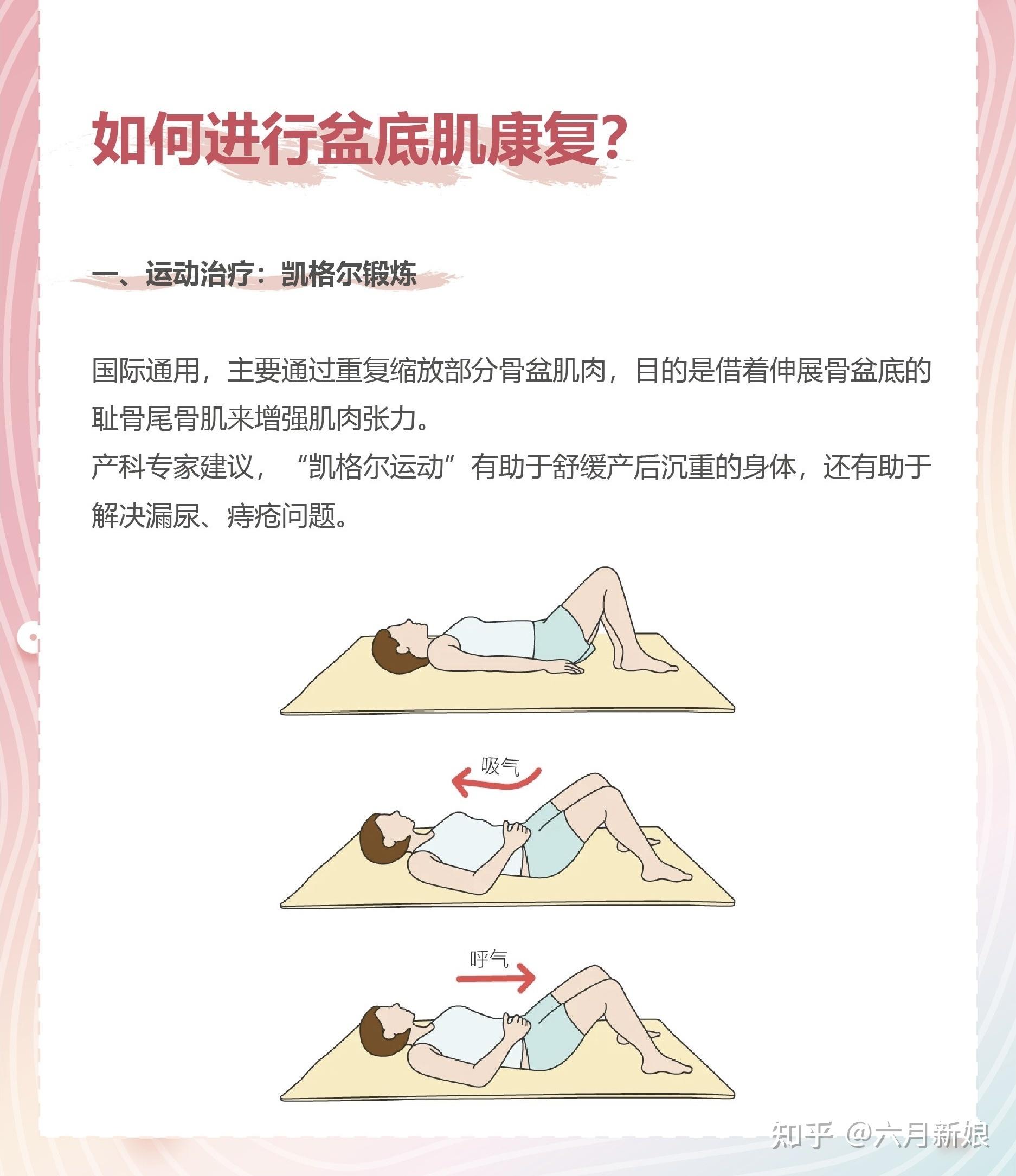 今天去医院,医生建议做盆底肌肉康复.1200元10次,有人做吗?