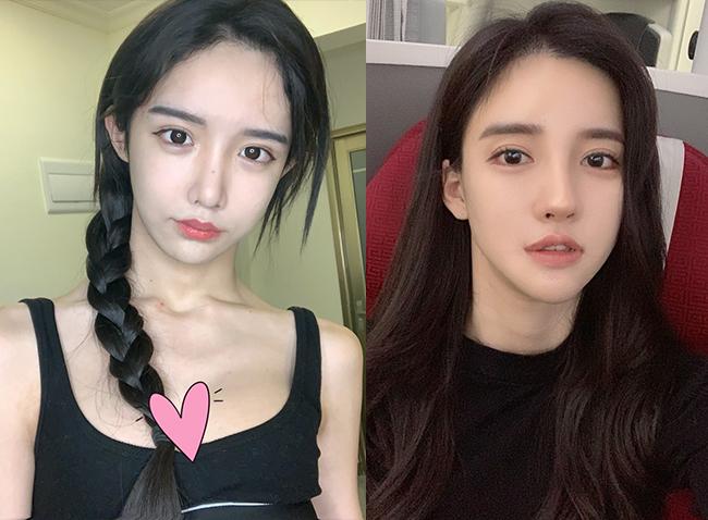 女装大佬艾比abbily撞脸潘南奎科普网红流水线整容的致命弊端