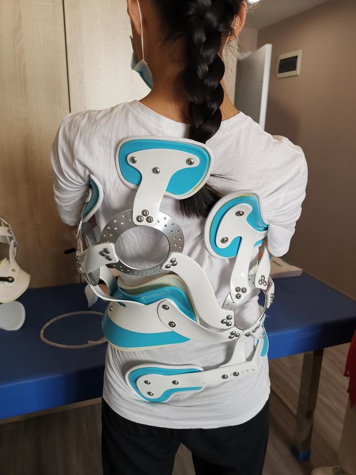 脊柱侧弯矫形器有没有使用年限