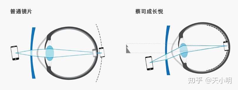 渐进镜你知道多少? - 知乎