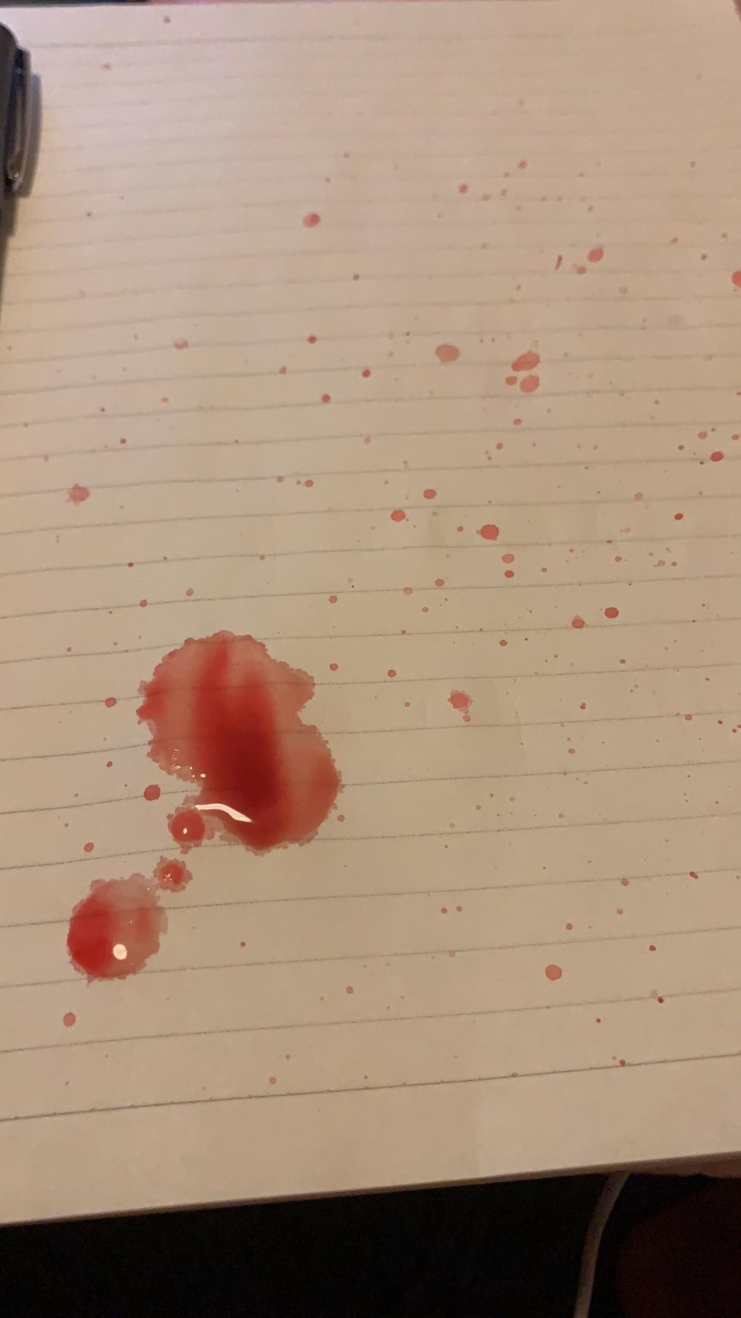 伤心过度为什么会吐血