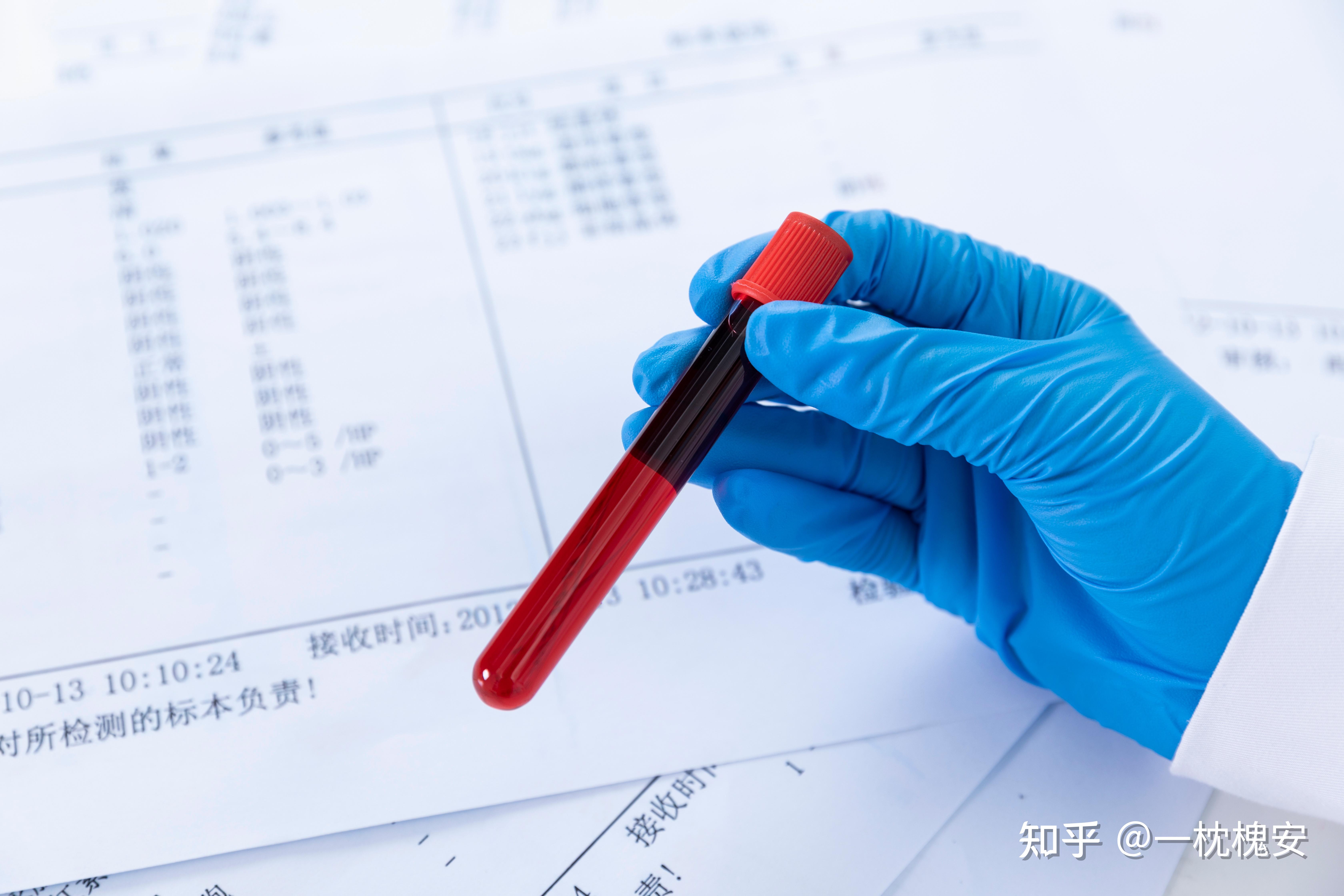 课题的创新之处如何写? - 知乎
