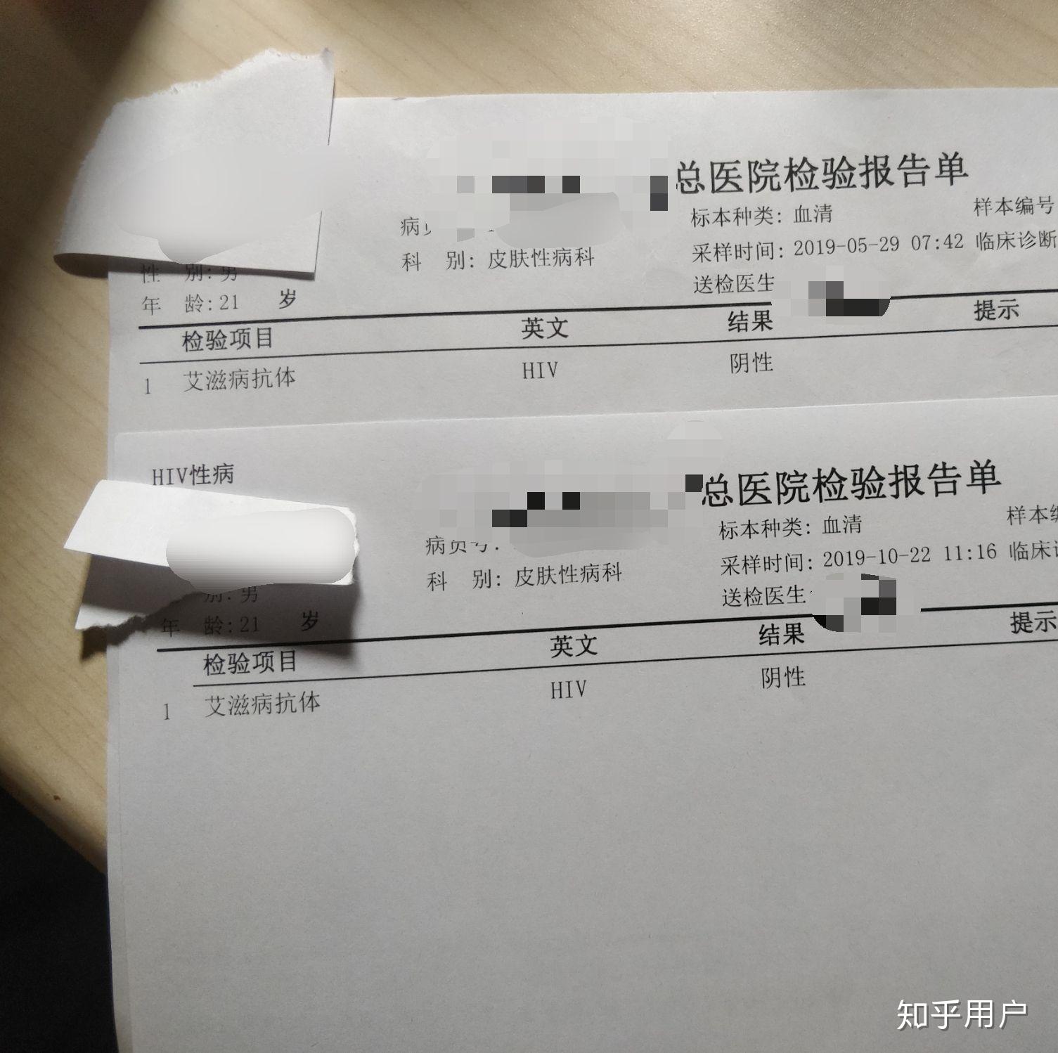 检查艾滋病得知结果是阴性后是怎样一种体验