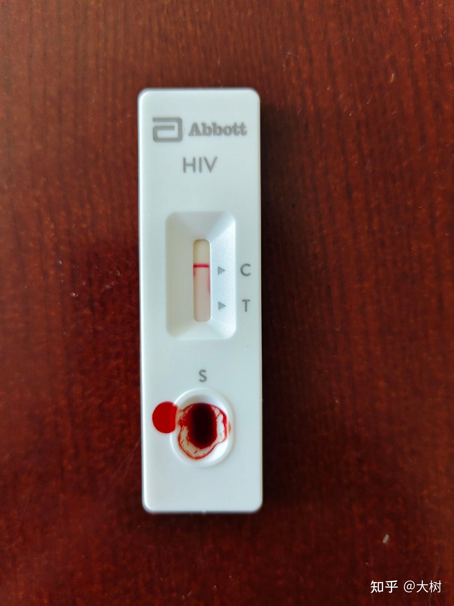 艾滋病测试纸多久可以排除