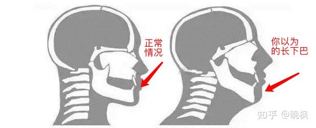 长下巴怎么变短？为什么下巴会比别人的长，我爸妈都不是长下巴？ 知乎 