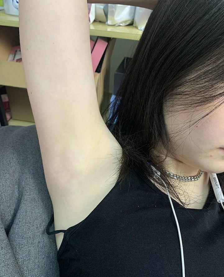 腋下一大片都好黑,还有腋毛好多.