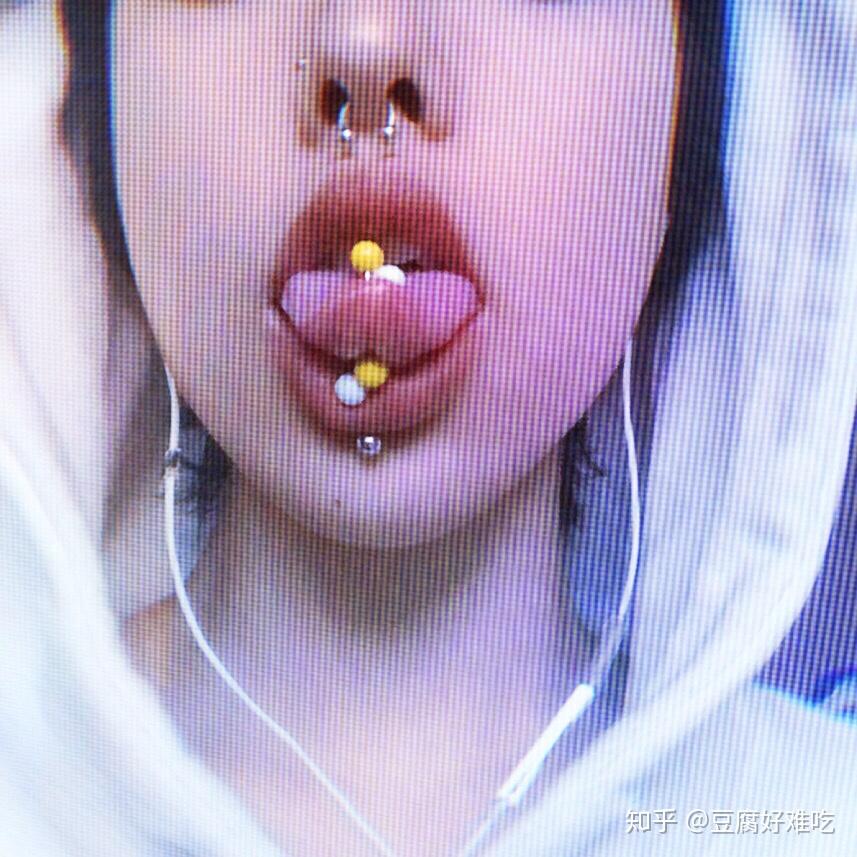 三个舌钉会影响说话或者影响其他的方面吗? - 知乎