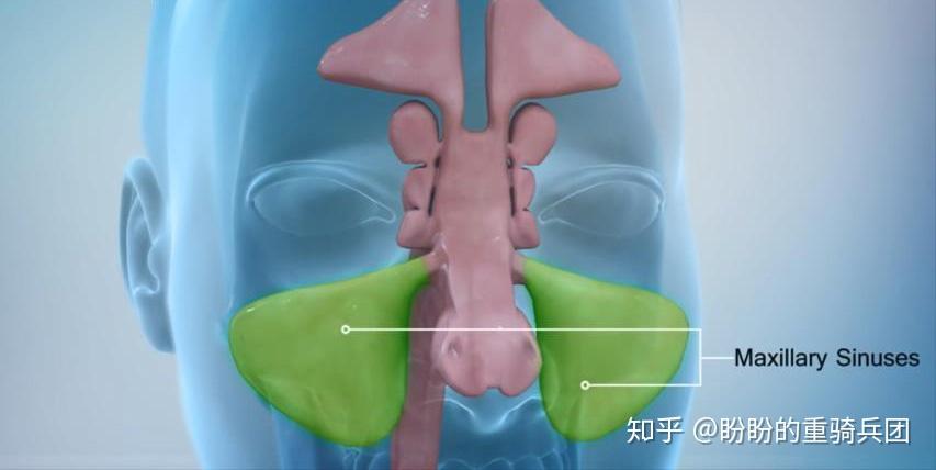 用解刨学知识解释为什么鼻窦炎中上颌窦炎最常见? - 知乎