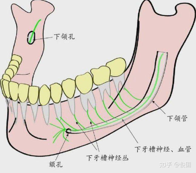 拔牙带出面神经怎么办？ - 知乎