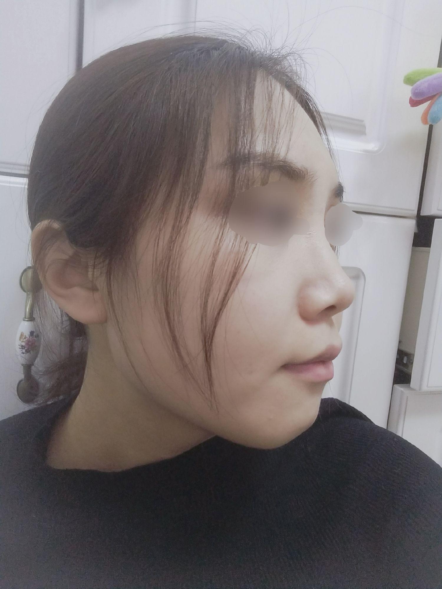 山根高但鼻梁低是什么体验