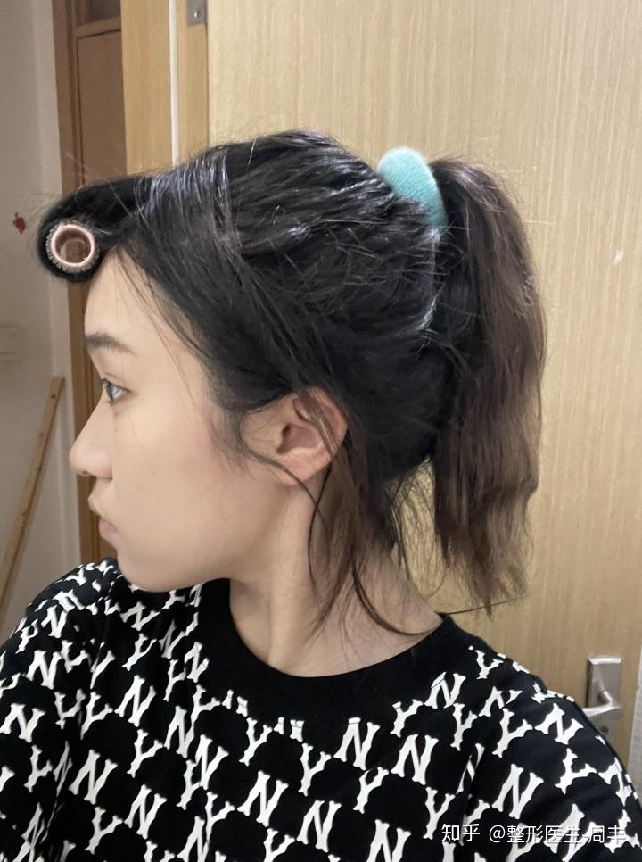 侧面看脸好丑好奇怪我这是什么情况是单纯的嘴凸吗