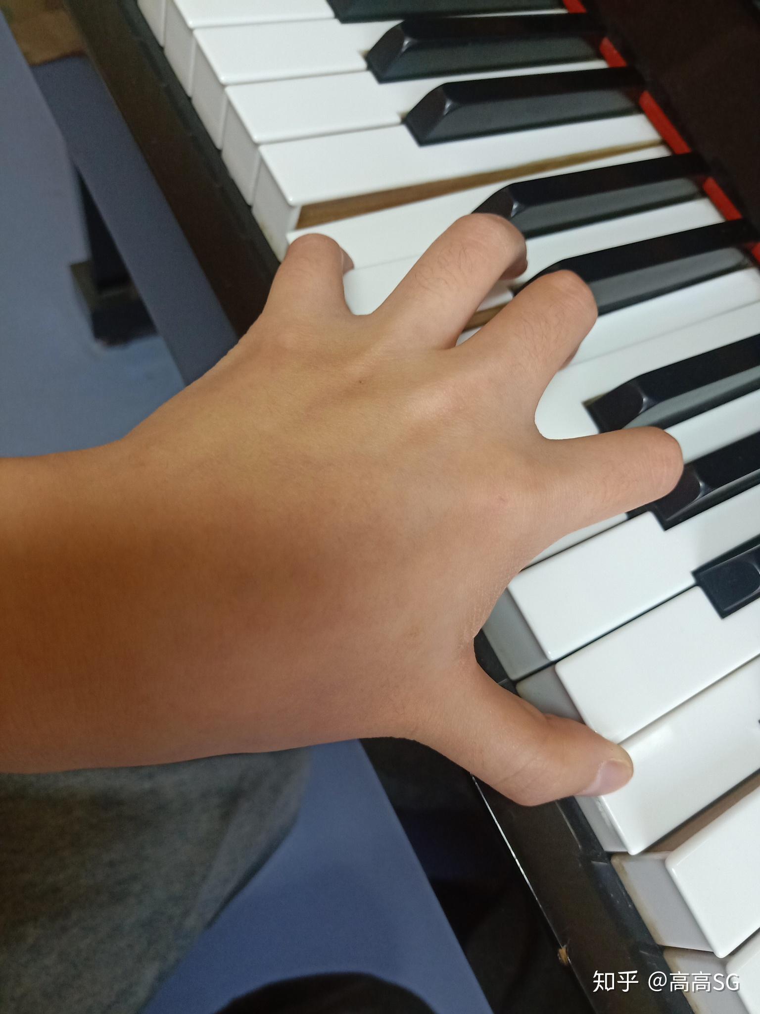 请问大家弹钢琴的时候右手大拇指关节凹陷如何解决如图
