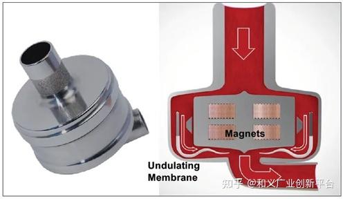 Corwave 人工心脏3——盘点10家长期VAD产品 - 知乎