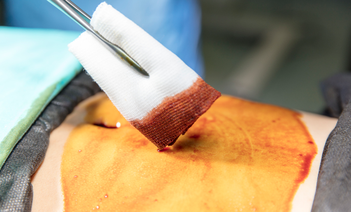 外科手术区消毒范围你还记得清楚吗