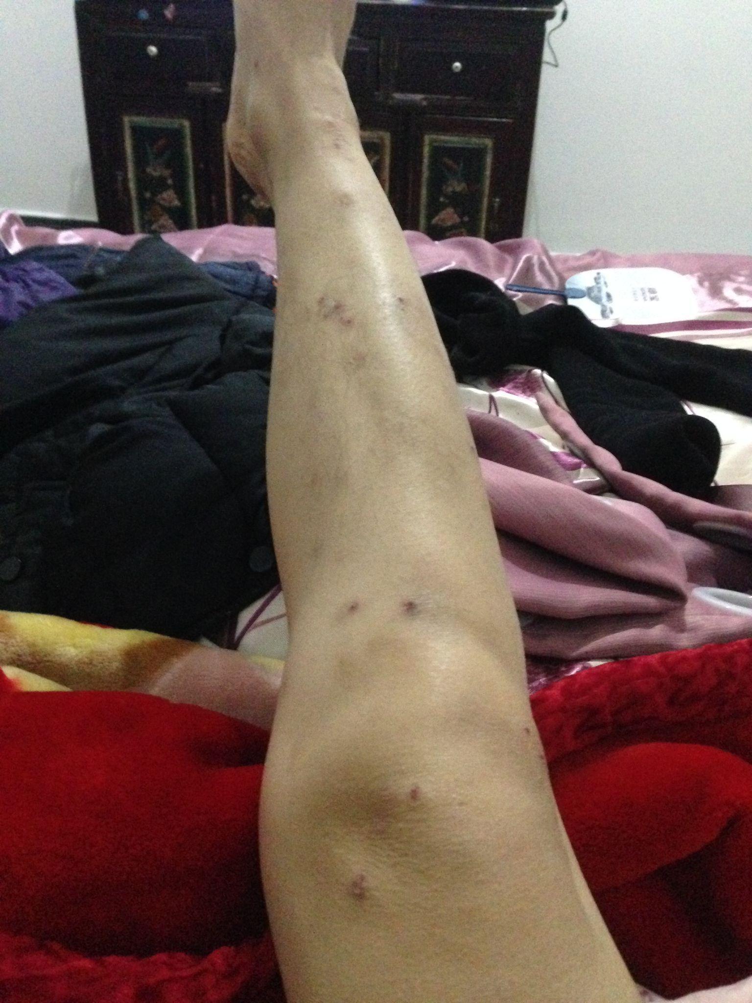 中医中药到底是科学还是玄学