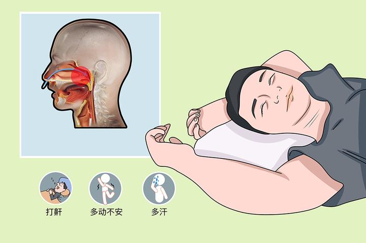 大脑不再传送呼吸指令？中枢睡眠呼吸暂停真的很可怕！ - 知乎