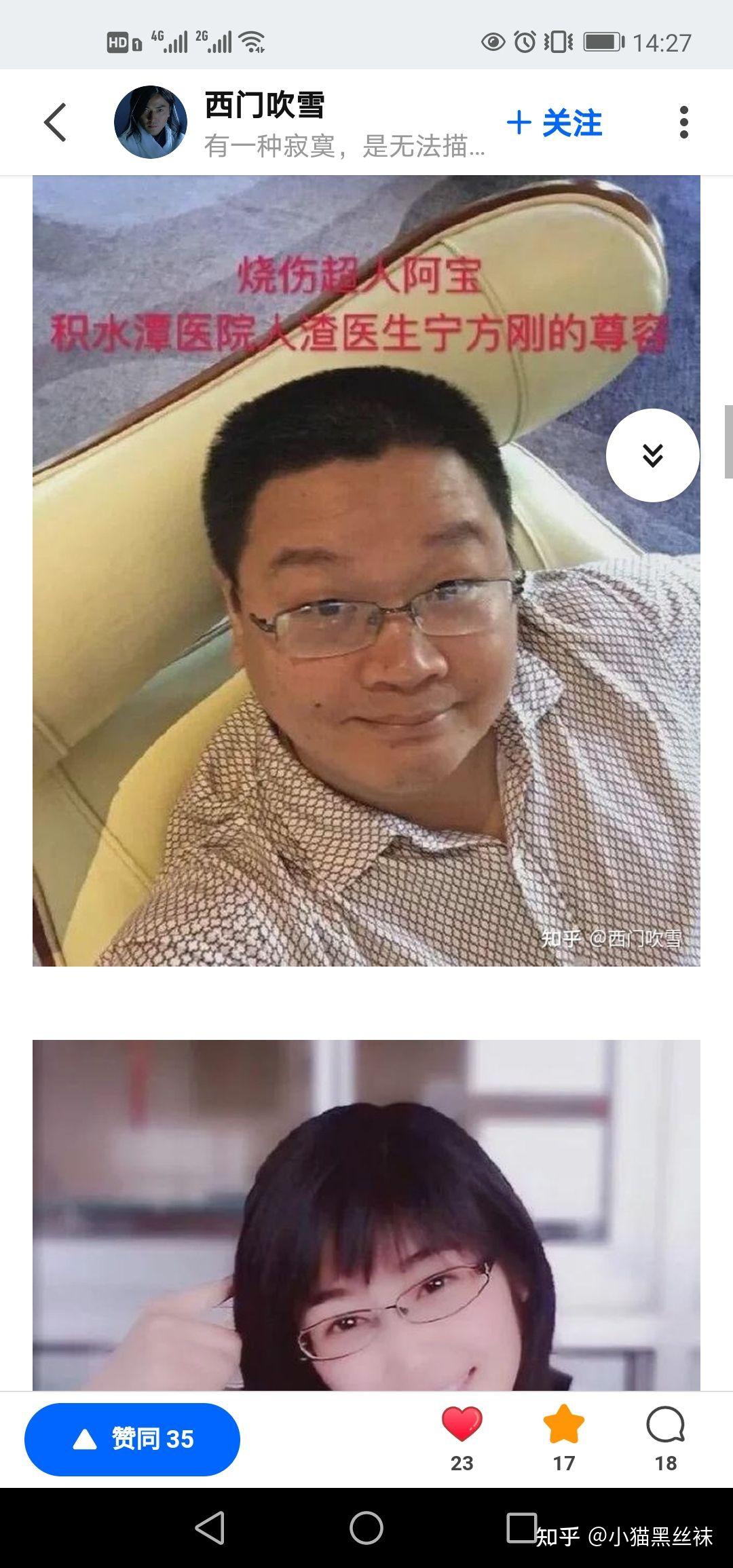 如何评价微博大v烧伤超人阿宝和一个有点理想的记者？ - 知乎