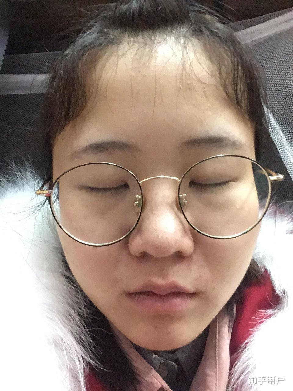 鼻头肉多且大鼻梁高中分是否会更突出鼻子怎样化妆去弱化鼻子在整张脸