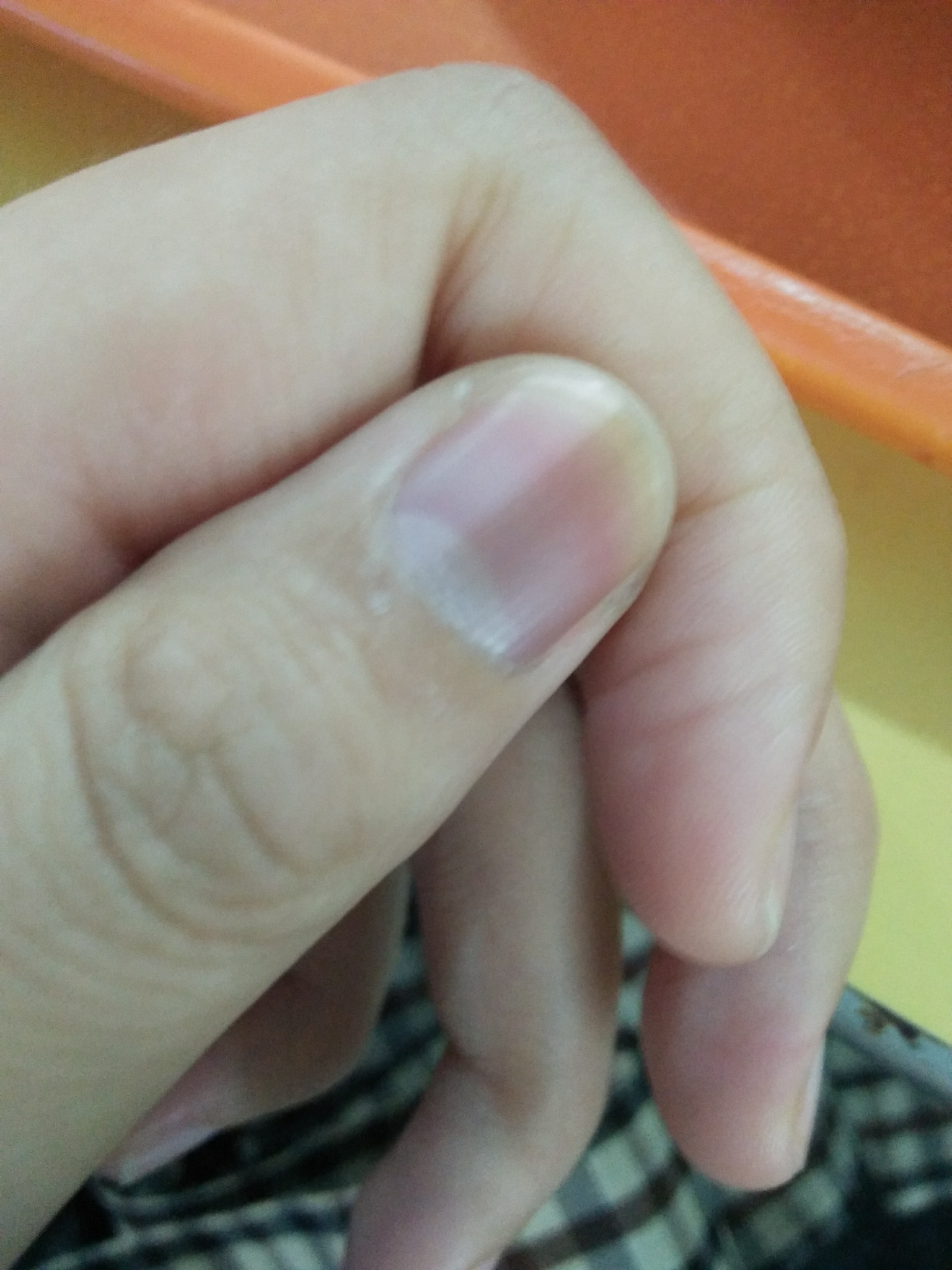 手指甲中有条黑线是怎么了