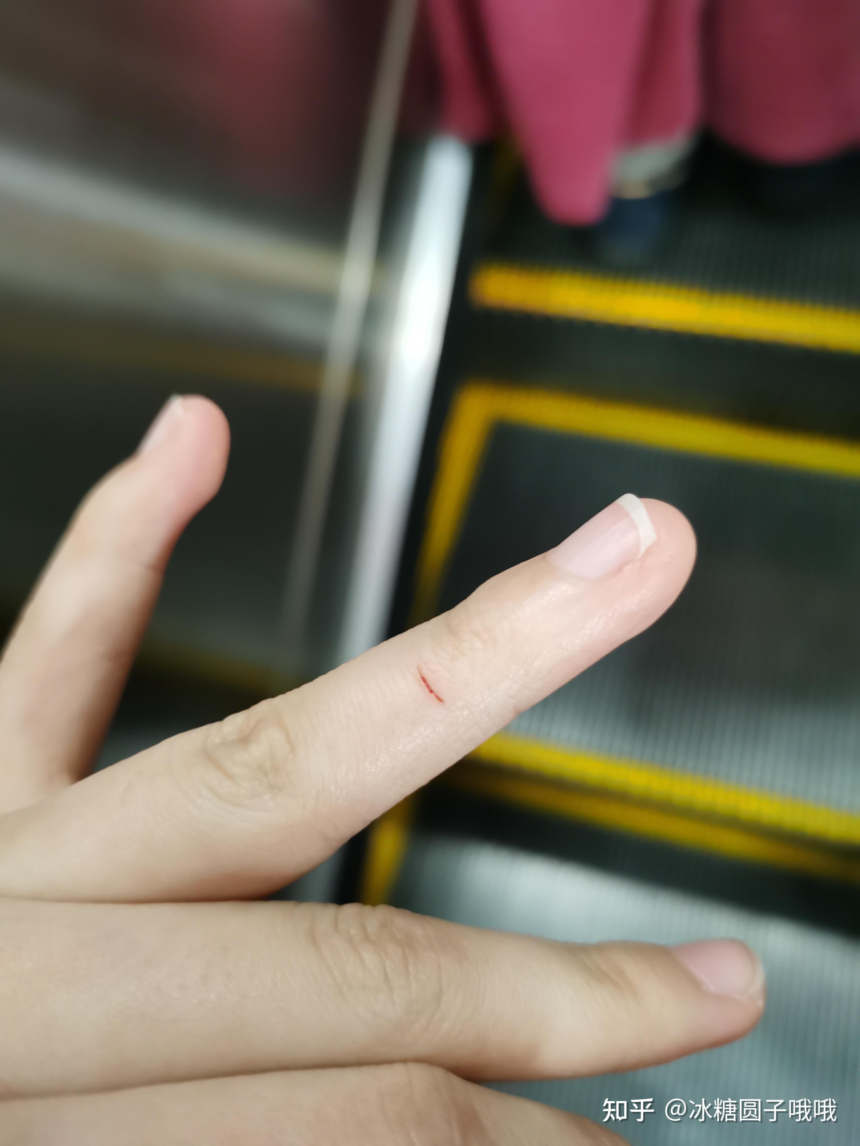 在猫咖被猫咪抓伤了怎么办? - 知乎