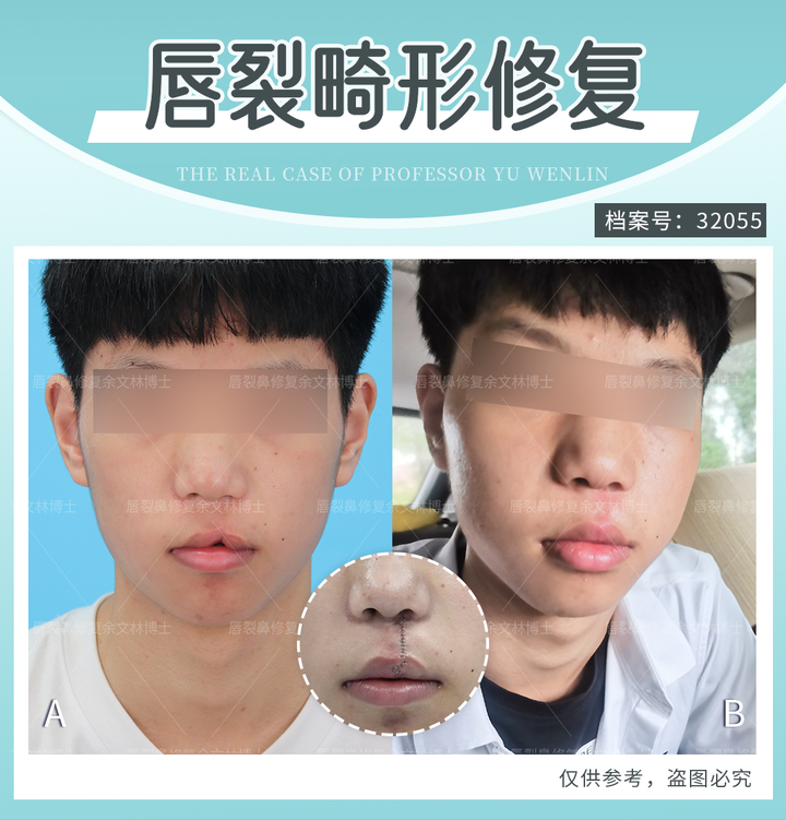 人中可以做出来吗? - 知乎