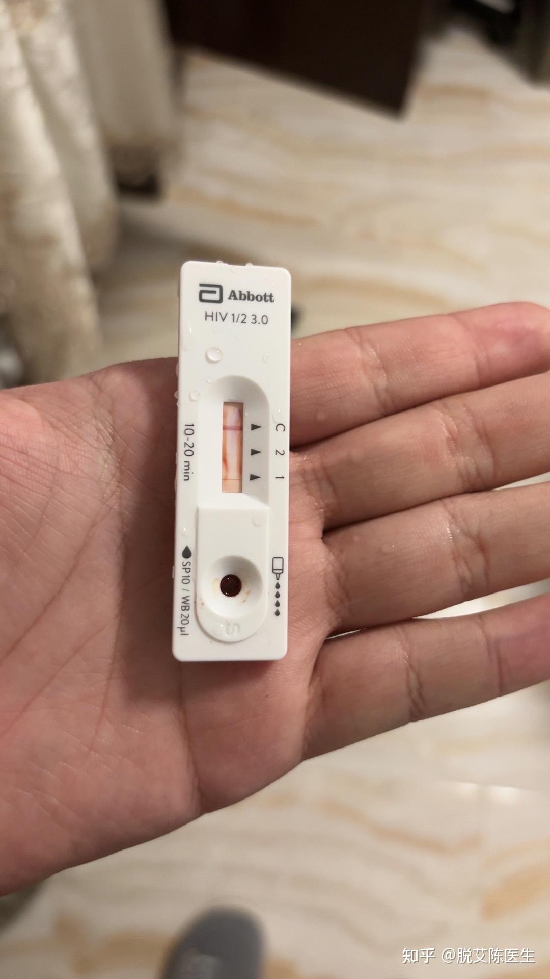 hiv试纸这个是包埋线吗