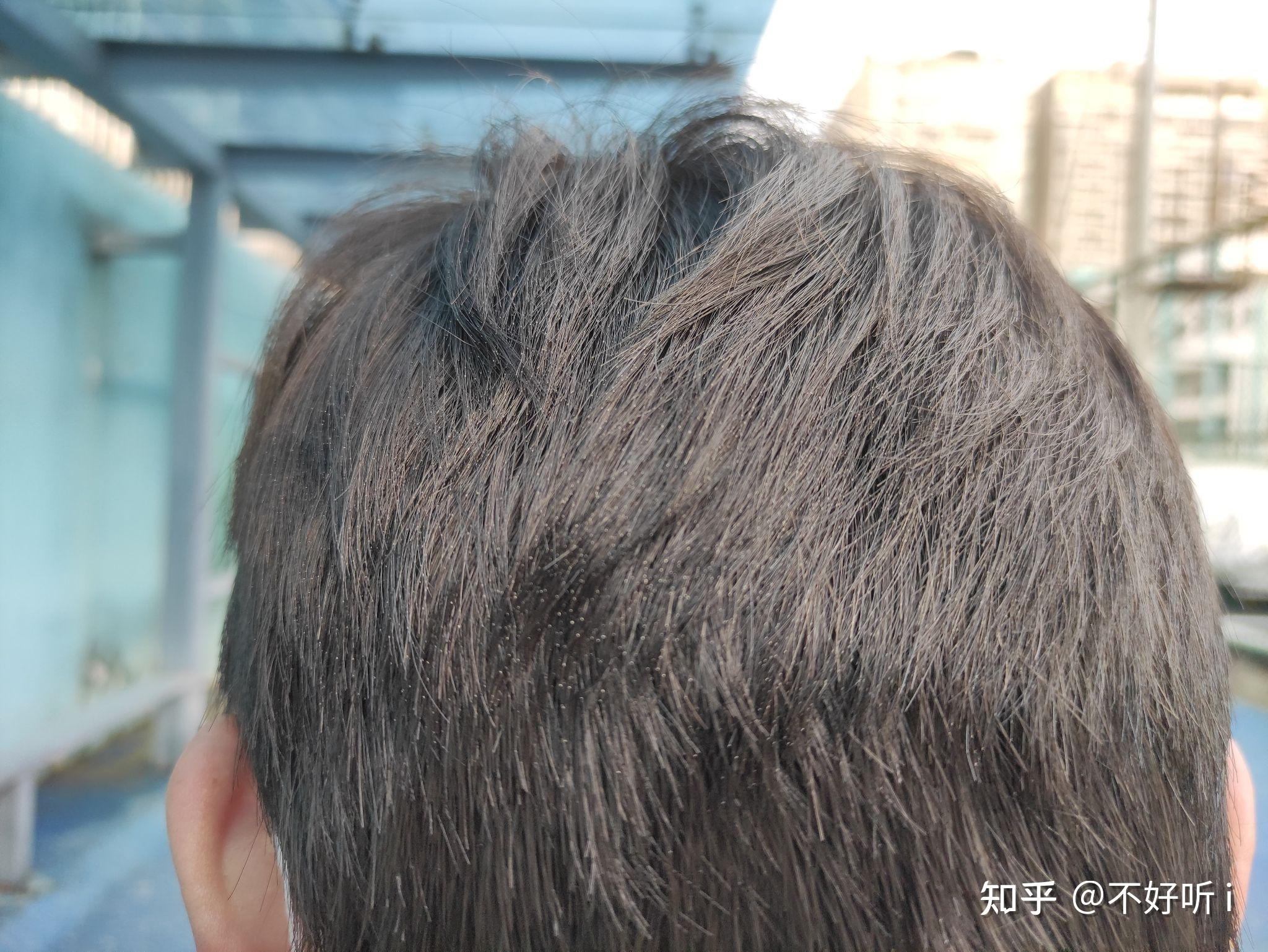 头发发梢有很多白点,白点处很脆弱,非常容易断,这是怎么回事? - 知乎