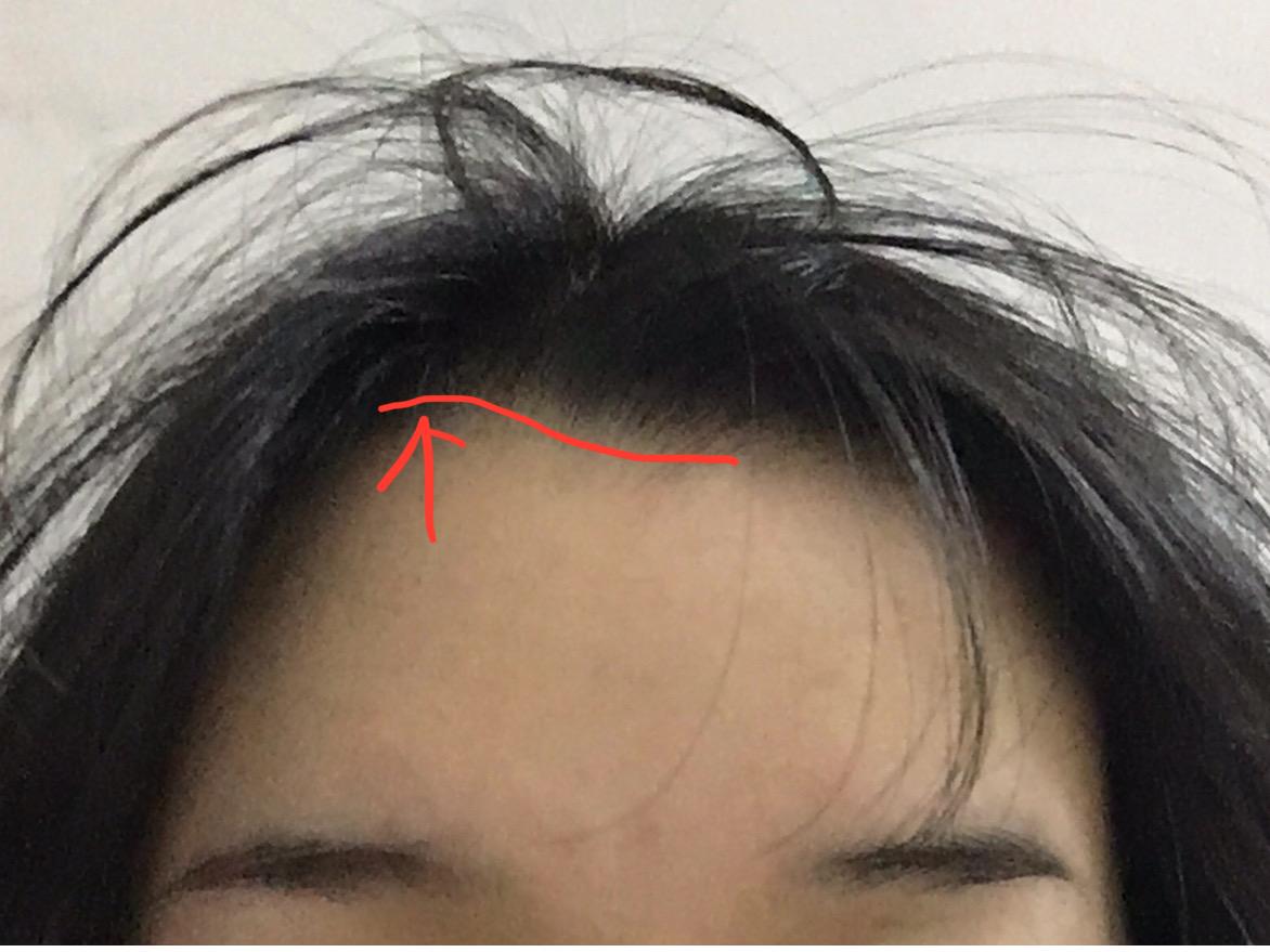 女生发际线处有个旋，很难做发型，有同胞么？怎么破！！？ - 知乎