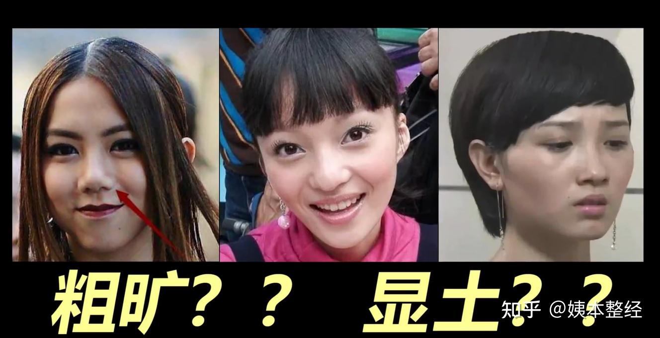 蒜头鼻怎样改善?