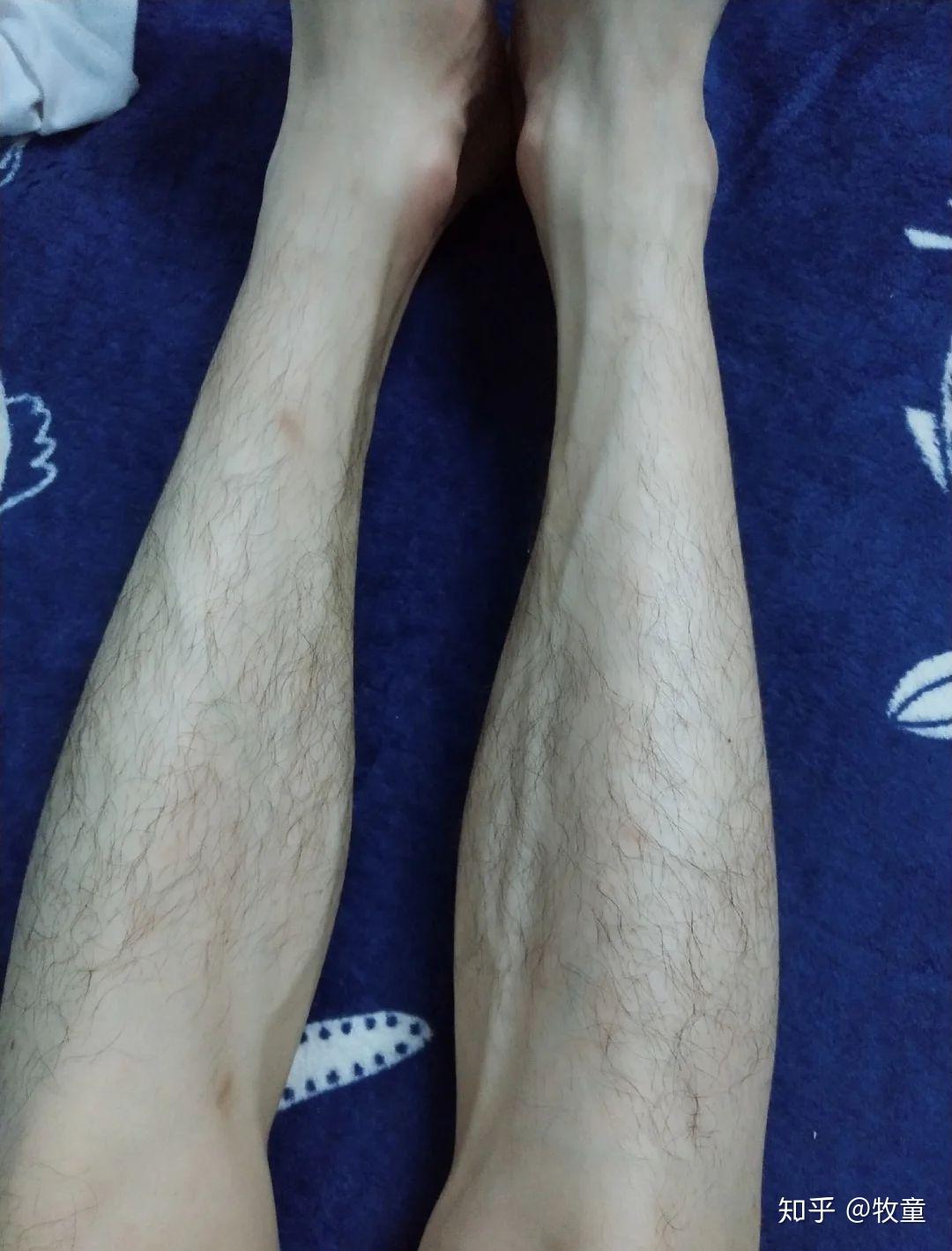 女生会嫌弃男生有浓密的腿毛吗,? - 知乎