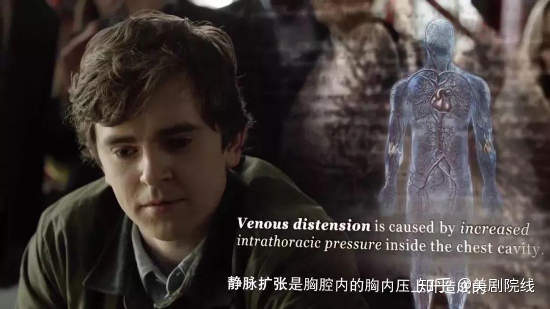 推荐一部可以通宵看的美剧,《良医》 - 知乎