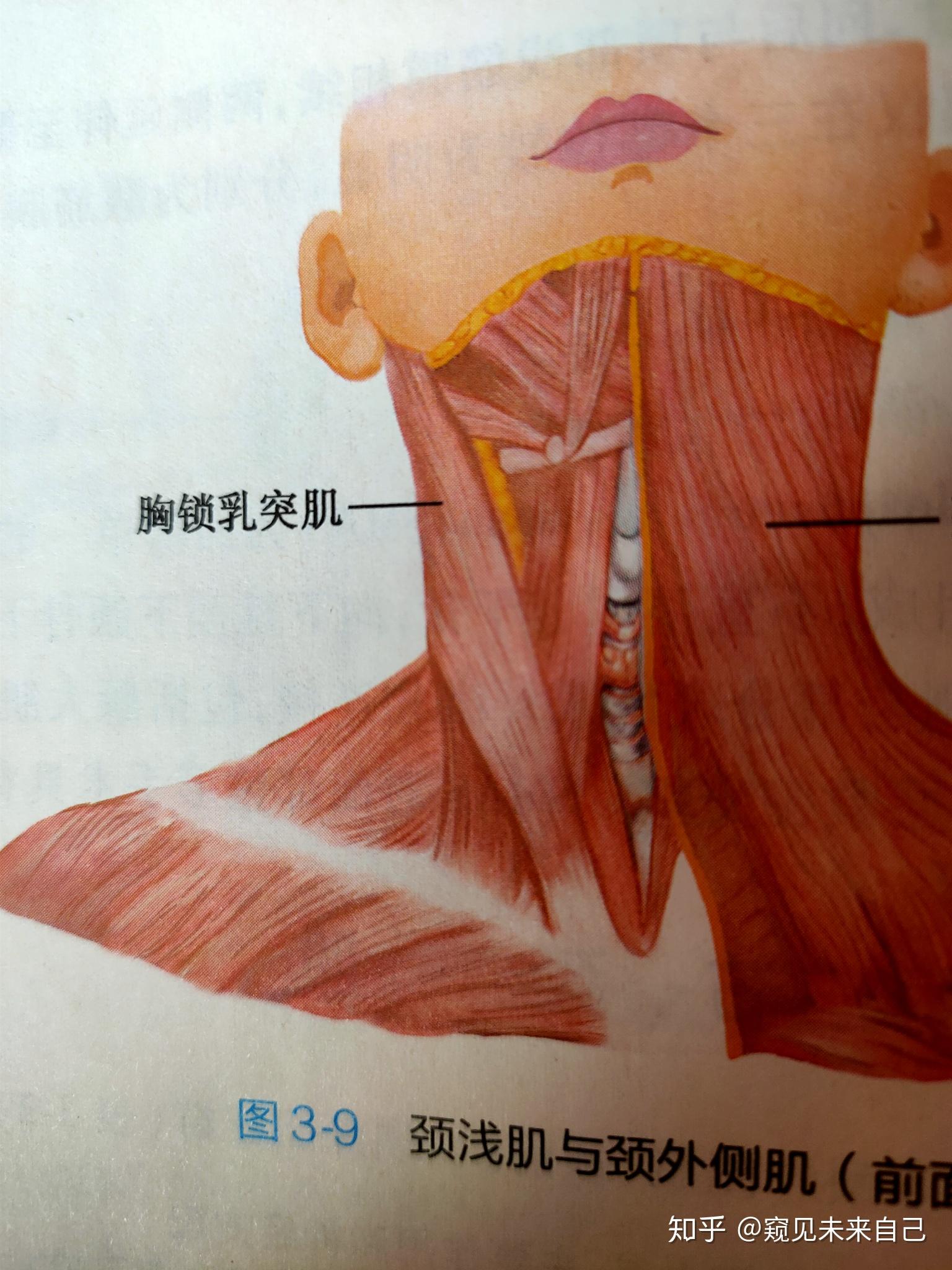 胸锁乳突肌两侧收缩为什么是使头后仰?