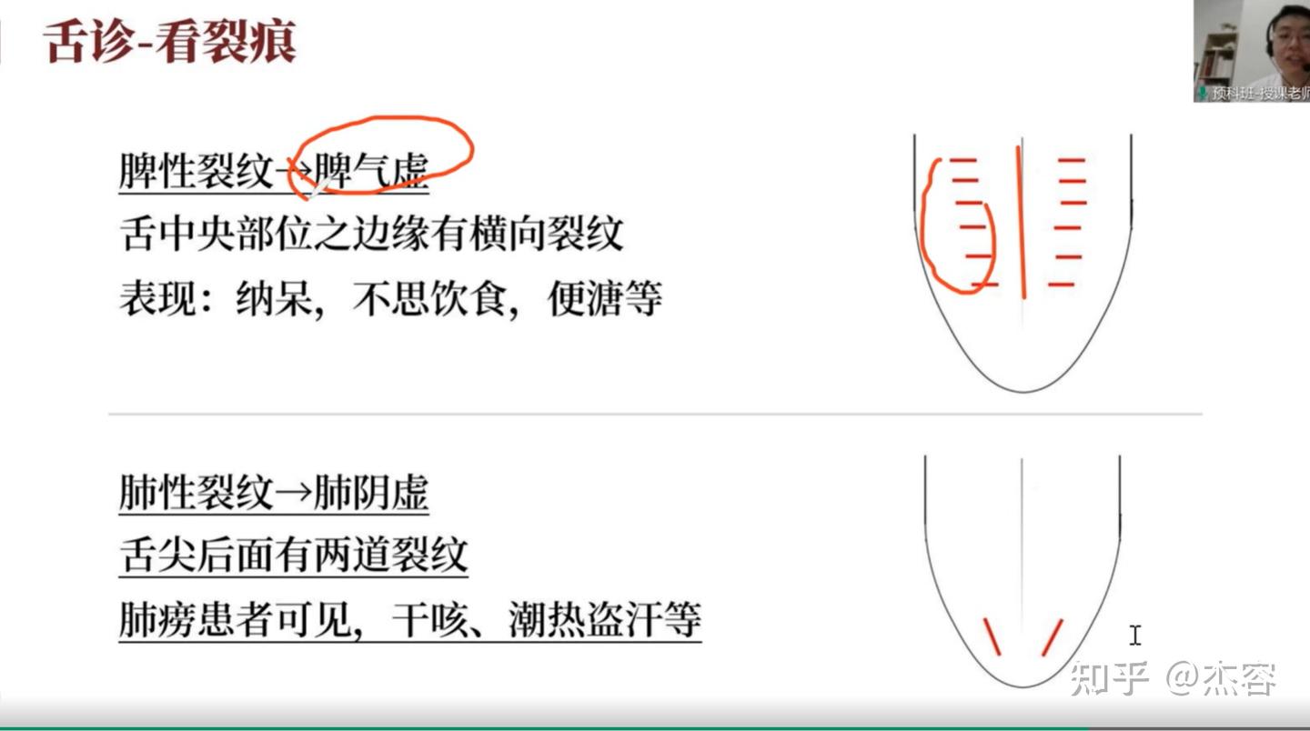中医学习笔记5:舌诊 - 知乎
