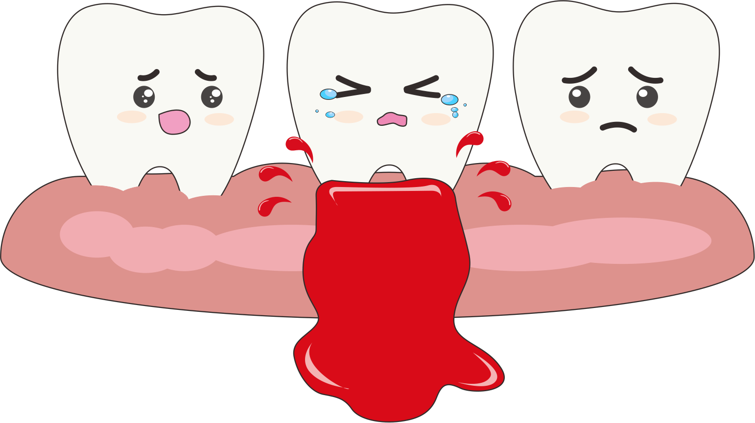 牙龈发炎怎么办快速解决（牙龈发炎怎么办？这八招学会缓解疼痛，预防牙龈炎口腔健康） | 说明书网