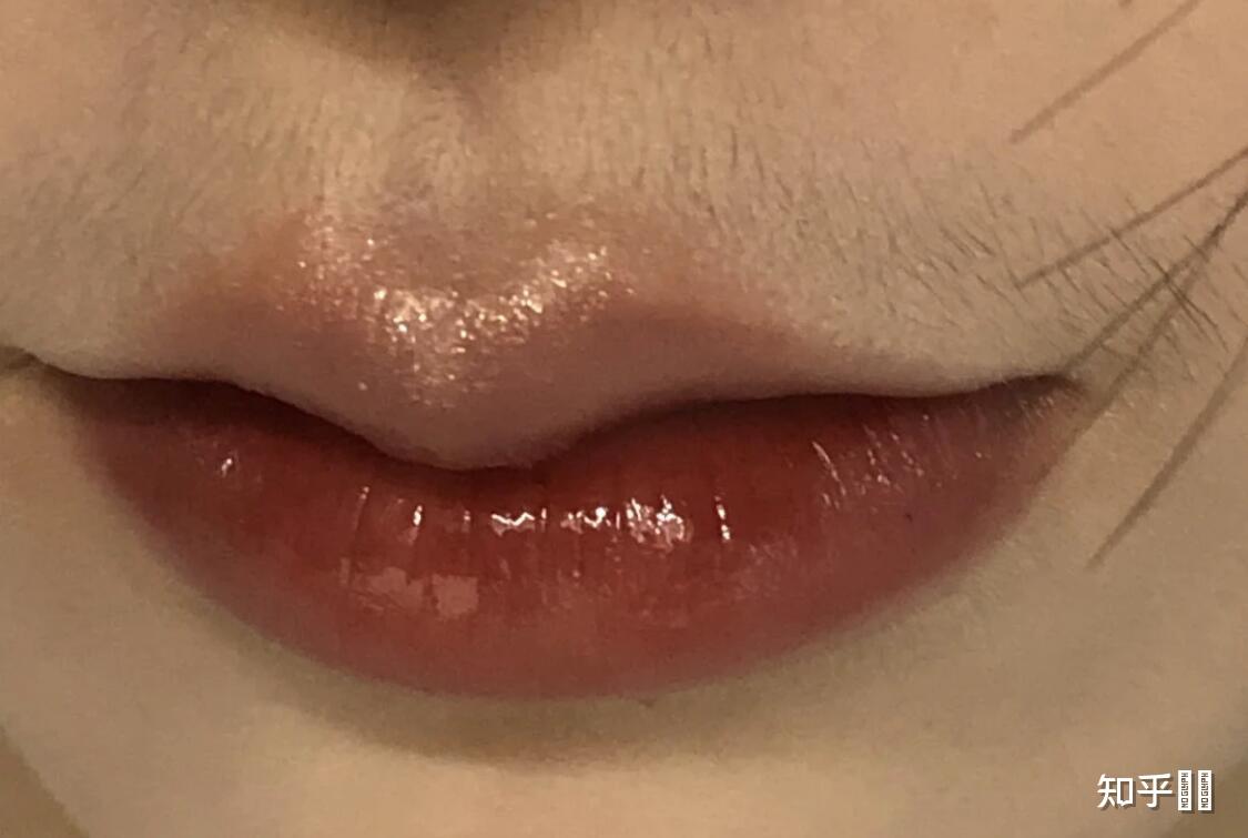 女孩子的唇毛很重怎么办